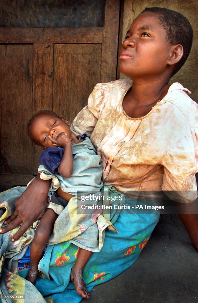 Famine in Malawi