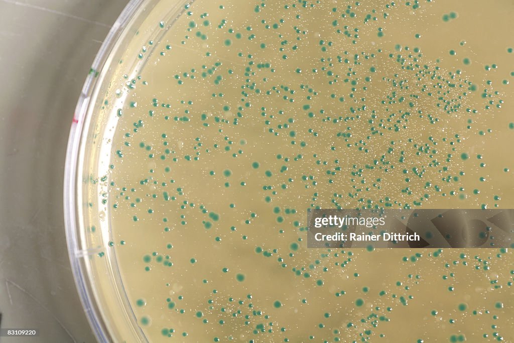 Antibiotics in Petri dish