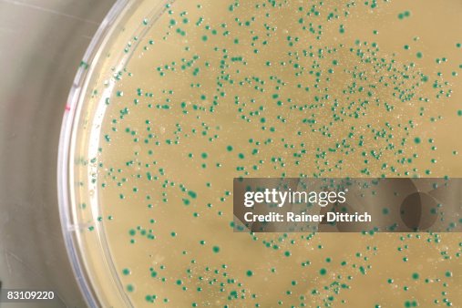Antibiotics in Petri dish Antibiotics in Petri dish
