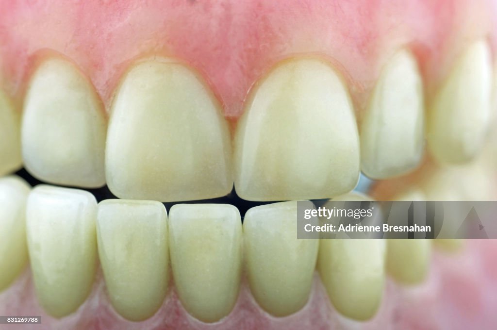 Dental Model of Teeth, Close-up
