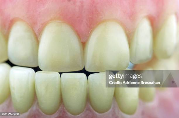 dental model of teeth, close-up - gengive umane foto e immagini stock