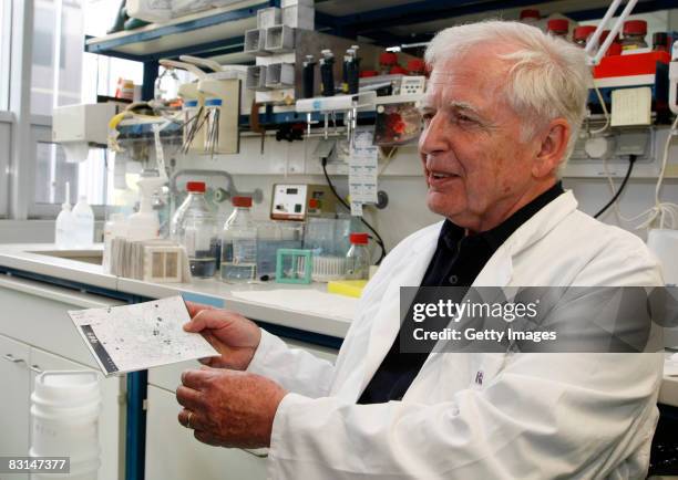 German scientist Harald zur Hausen shows a photo of human papilloma virus in the labor at the German Cancer Research Center on October 6, 2008 in...