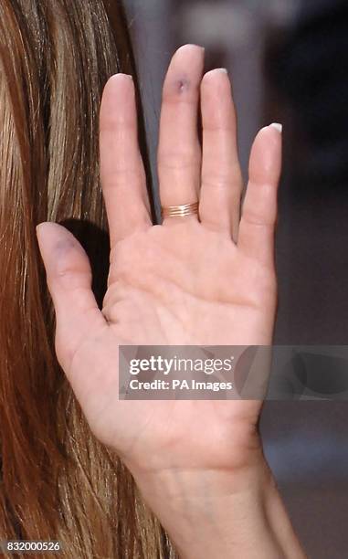 Jennifer Aniston with a cut/bruise on her finger, as shearrives at the UK film premiere of The Break Up, at the Vue West End cinema, central London.