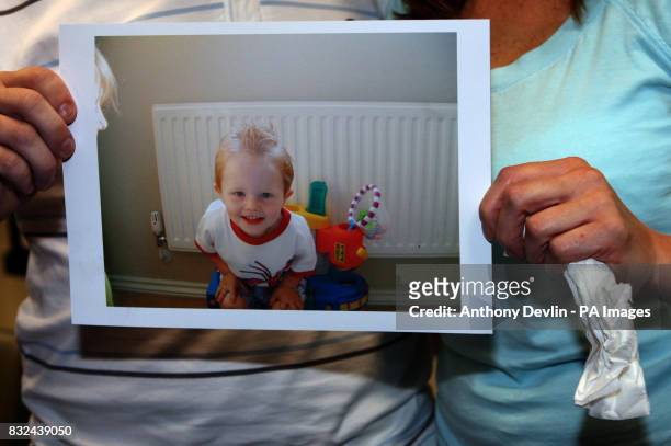 Mark Lawrence and Clare Carey, hold a pictre of their son Harvey Lawrence who was attacked by a Rottweiler, speak at a press conference at St...