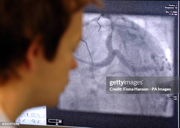 Angiogram Display 184 Heart Angiogram Stock Photos, High-Res Pictures, and Images - Getty ...