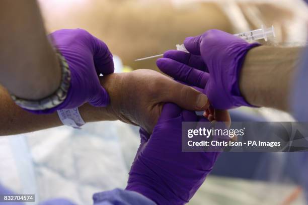 An anaesthetist inserts an arterial line to monitor a patient's blood pressure before a Laparoscopic Anterior Resection at the Royal Hampshire County...