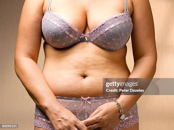 stomach with cellulite - human abdomen foto e immagini stock