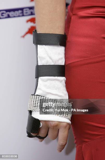 Close up of the injured wrist of Aisleyne Horgan-Wallace as she arrives for the Miss Great Britain Finals, at Grosvenor House in central London.