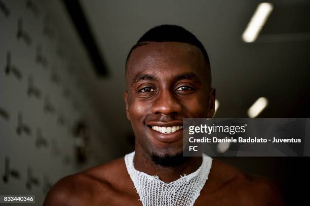 Juventus New Signing Blaise Matuidi attends medical tests on August 17, 2017 in Turin, Italy.