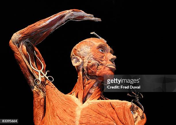 Exhibit at the Body Worlds & The Mirror of Time exhibition at the O2 on October 24, 2008 in London, England.