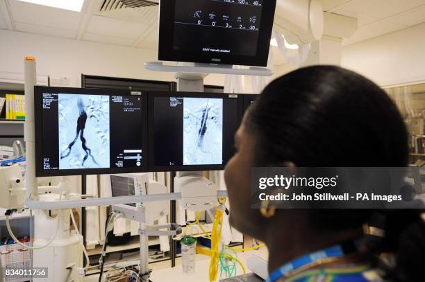 Angiogram Machine Test 12 Angiography Suite Stock Photos, High-Res Pictures, and Images ...