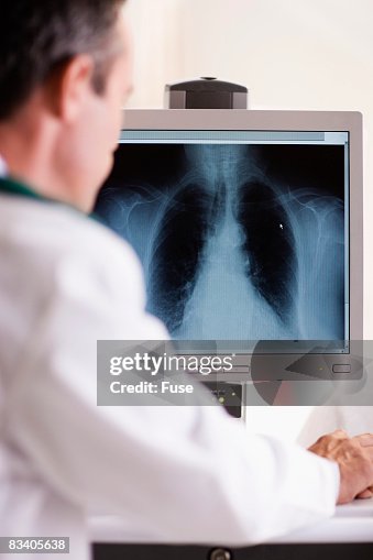 Computer Screen Rx Doctor Examining Xray On Computer Monitor High-Res Stock Photo - Getty ...