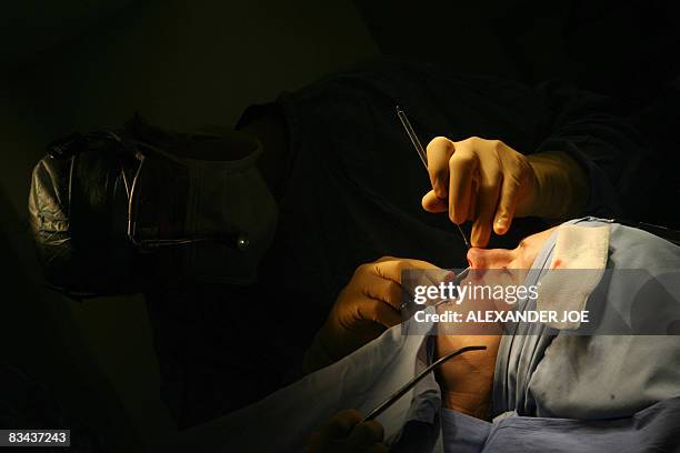 Sibongile Khumalo South African Doctor Rick peforms a nose plastic surgery on a British patient in Johannesburg on October 23, 2008. Forget Africa's...