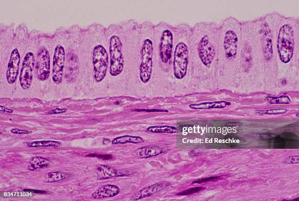 simple columnar epithelium, uterus, human--250x - muskelfaser stock-fotos und bilder