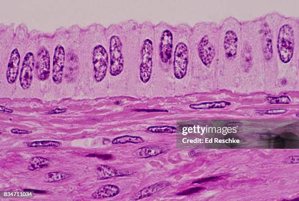 simple columnar epithelium, uterus, human--250x - simple columnar epithelial cell ストックフォトと画像