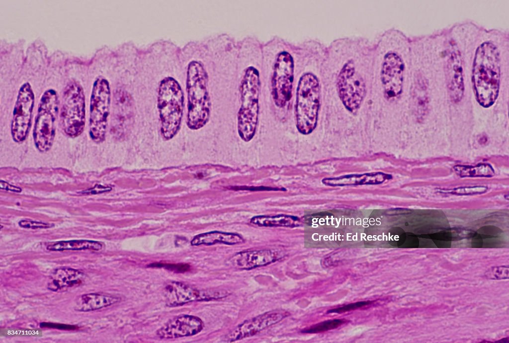 Simple Columnar Epithelium, Uterus, Human--250X
