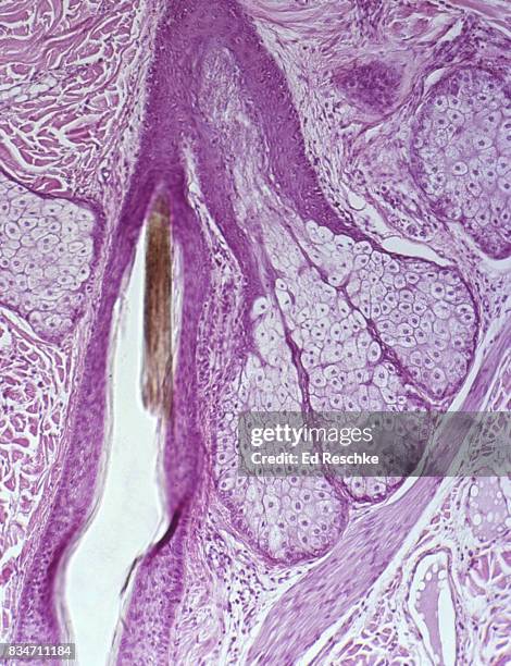 sebaceous glands, hair follicle and arrector pili muscle--scalp (human) 50x - sebaceous gland stock pictures, royalty-free photos & images