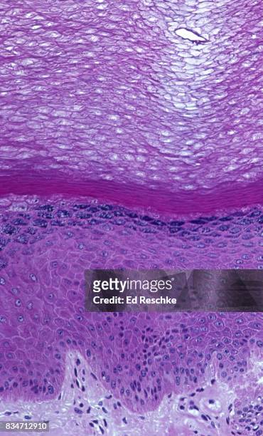 epidermis of skin showing all five layers--thick skin, palm of hand, 50x - glad spierweefsel stockfoto's en -beelden