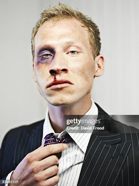 stock market broker after a beating - blauwe ogen stockfoto's en -beelden