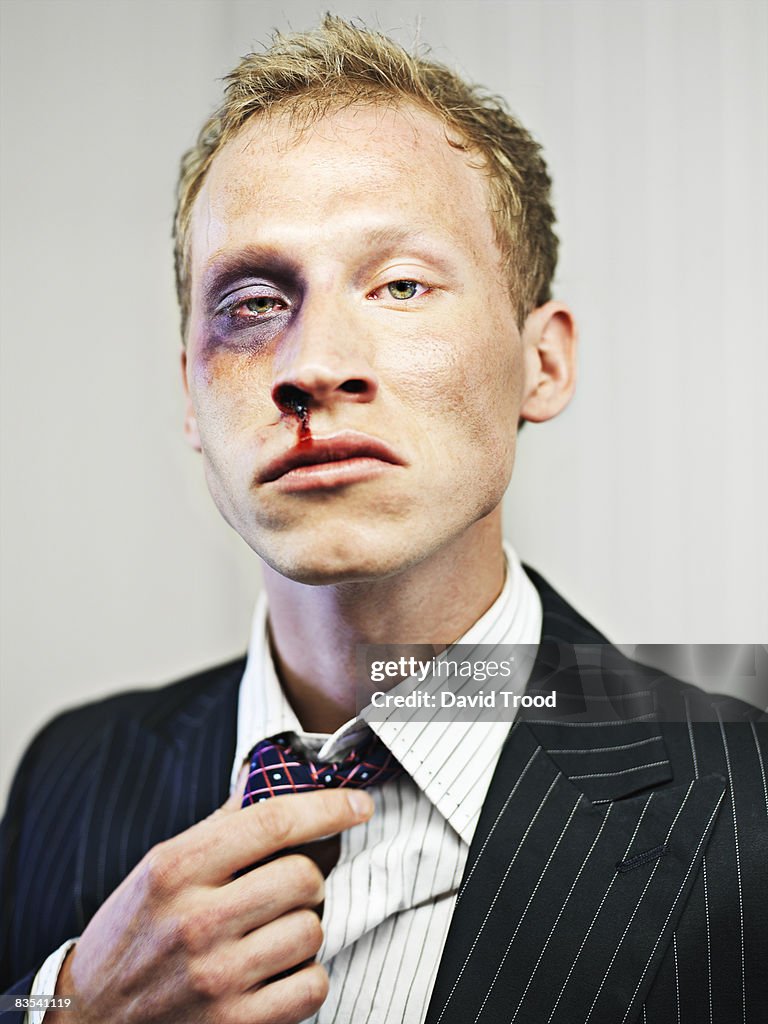 Stock market broker after a beating