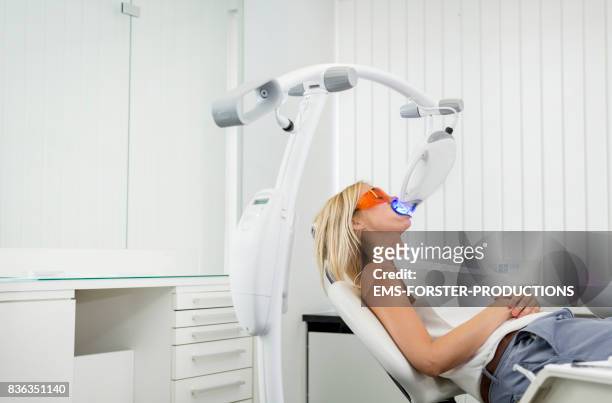 aesthetic cosmetic dentistry dental care - women with long blonde hair lying on dentist’s office chair with mouth open for tooth bleaching while wearing protective glasses and lip retractor is inserted the whitening unit is emitting ultraviolet light. - retractor stock pictures, royalty-free photos & images