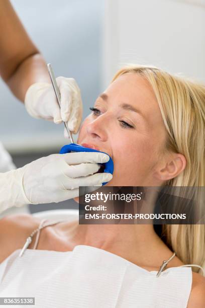 cosmetic dentistry dentist’s office - women in her 30s with long blonde hair lying on chair with open mouth for bleaching, female doctor with latex, one use, exam gloves applies blue dental cheek lip retractor mouth opener in o shape with angled mirror. - retractor stock pictures, royalty-free photos & images