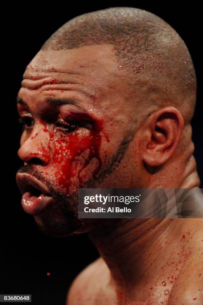 Roy Jones Jr's wound bleeds down his face while fighting against Joe Calzaghe of Wales in their Ring Magazine Light Heavyweight Championship bout at...