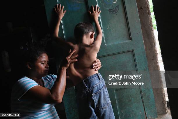 Sonia Morales massages the back of her son Jose Issac Morales at the door of their one-room home on August 20, 2017 in San Pedro Sula, Honduras. The...