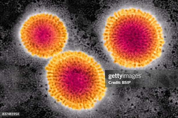 Influenza virus. Image produced from an image taken with transmission electron microscopy. Viral diameter ranges from around 80 to 120 nm.