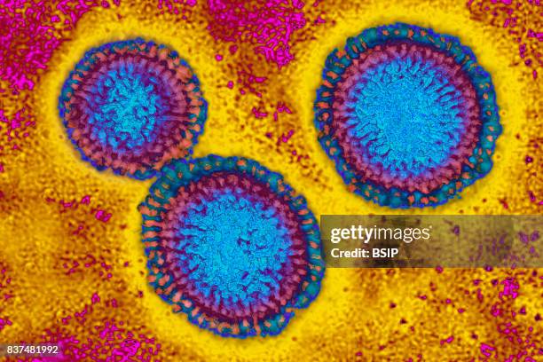 Influenza virus. Image produced from an image taken with transmission electron microscopy. Viral diameter ranges from around 80 to 120 nm.