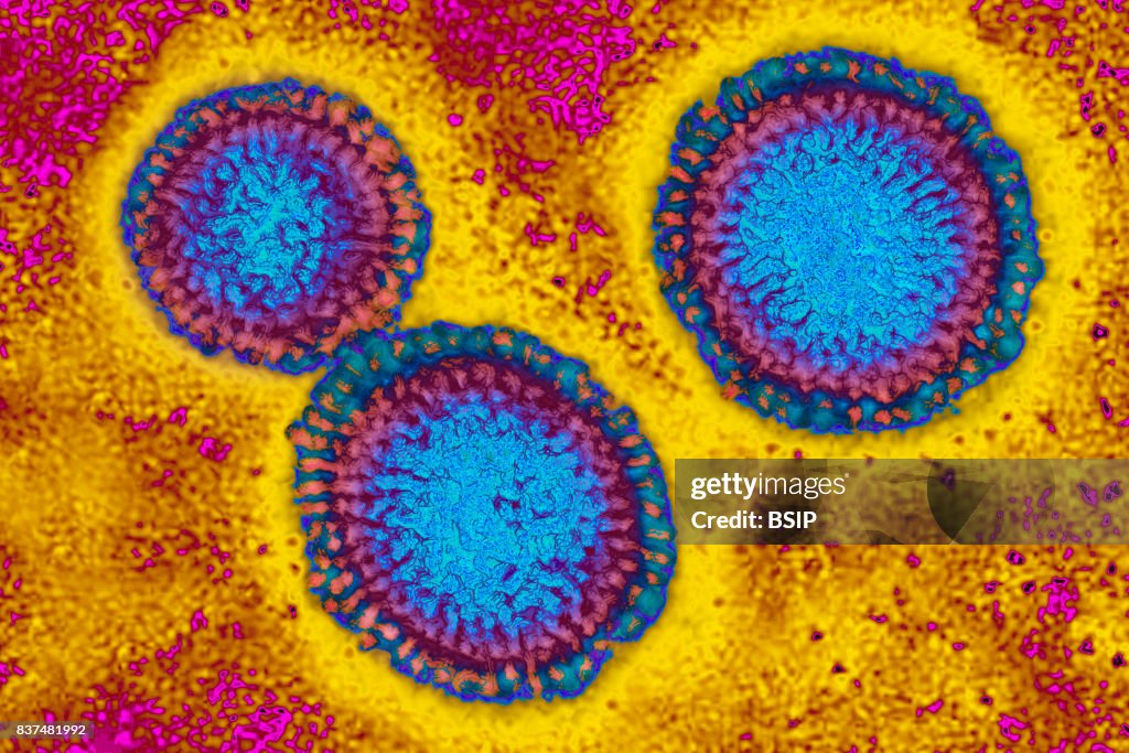 Influenza virus, tem