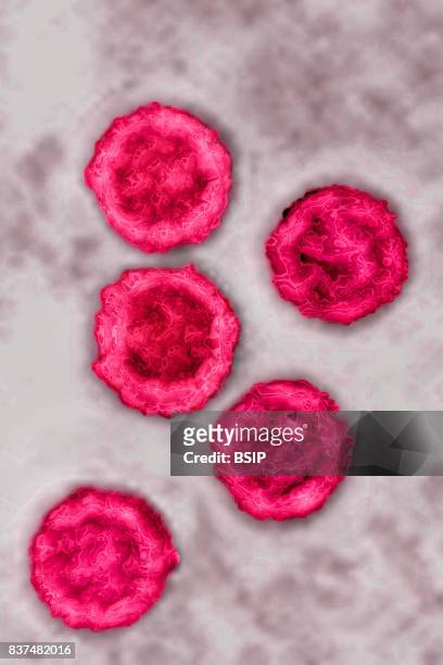 Human herpes virus, HSV). Image taken with transmission electron microscopy. HSV 1, causes or labial herpes. HSV 2, causes genital herpes. HSV 3,...