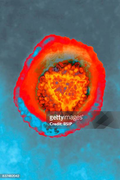 Human herpes virus, HSV). Image taken with transmission electron microscopy. HSV 1, causes or labial herpes. HSV 2, causes genital herpes. HSV 3,...