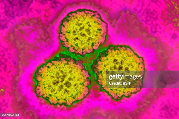 Papilloma virus, HPV). It causes cervical cancer. Image taken with transmission electron microscopy.