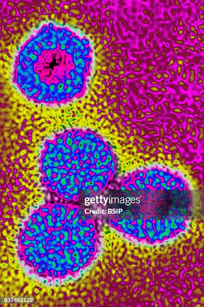 Rotabirus Rotavirus Photos and Premium High Res Pictures - Getty Images