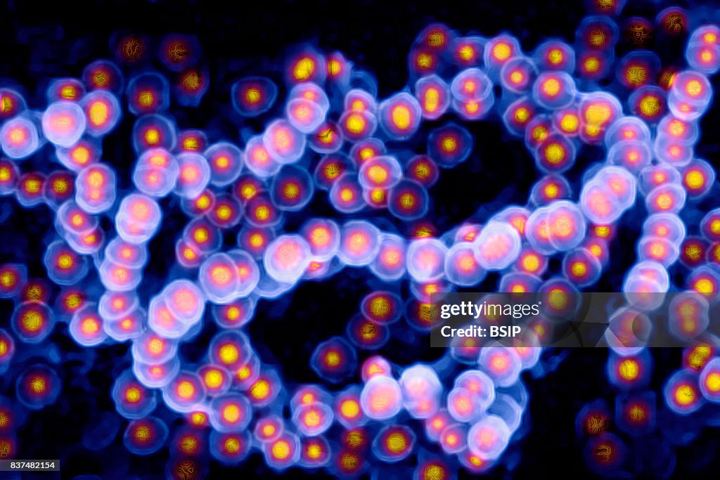 Streptococcus Pyogenes Microscope Streptococcus, Streptococcus pyogenes). Image taken from a microscope ...
