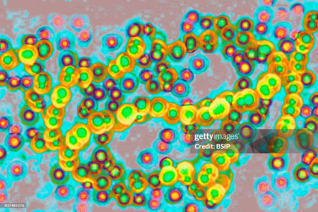Streptococcus Pyogenes Microscope Streptococcus, Streptococcus pyogenes). Image taken from a microscope ...