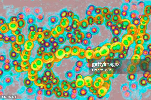 Streptococcus, Streptococcus pyogenes). Image taken from a microscope.