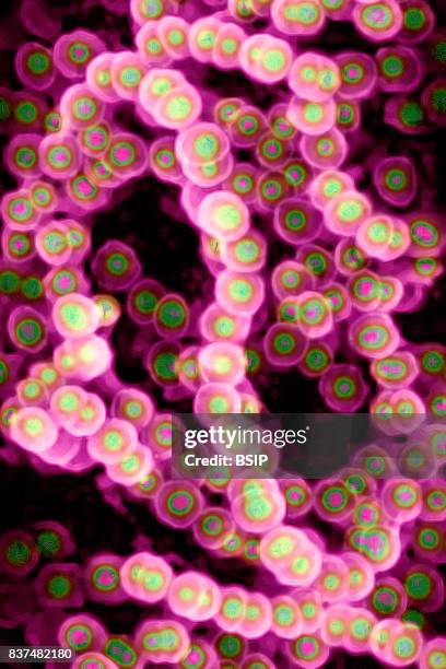 Streptococcus, Streptococcus pyogenes). Image taken from a microscope.