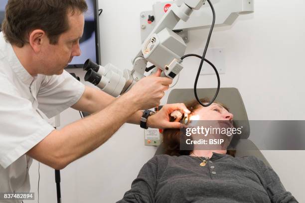 Doctor treating patients suffering from dizziness, Nice France, The doctor removes a plug of earwax.