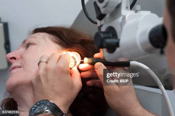 Doctor treating patients suffering from dizziness, Nice France, The doctor removes a plug of earwax.