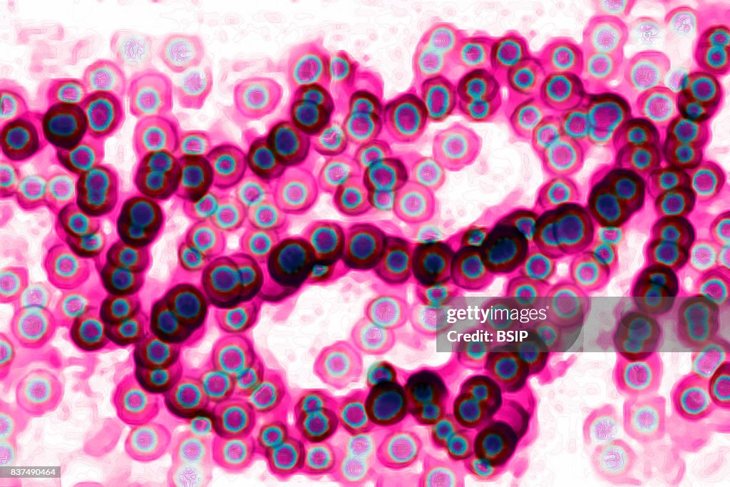 Streptococcus pyogenes