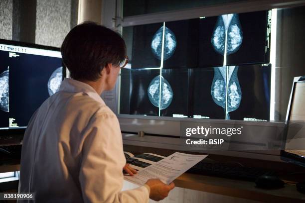 Radiology center, France, radiologist looks at the results of mammograms.