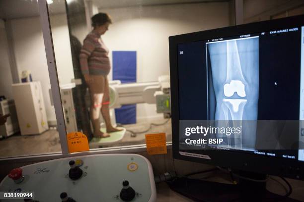 Radiology center, France, patient with a knee prosthesis has a check-up x-ray.