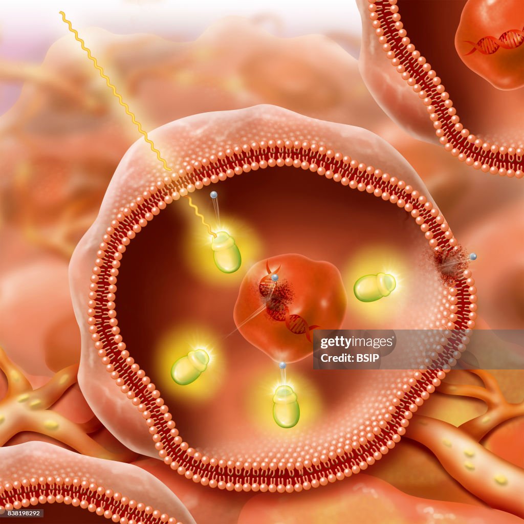 Illustration of radionuclide cancer treatment, release of a gamma ray ...
