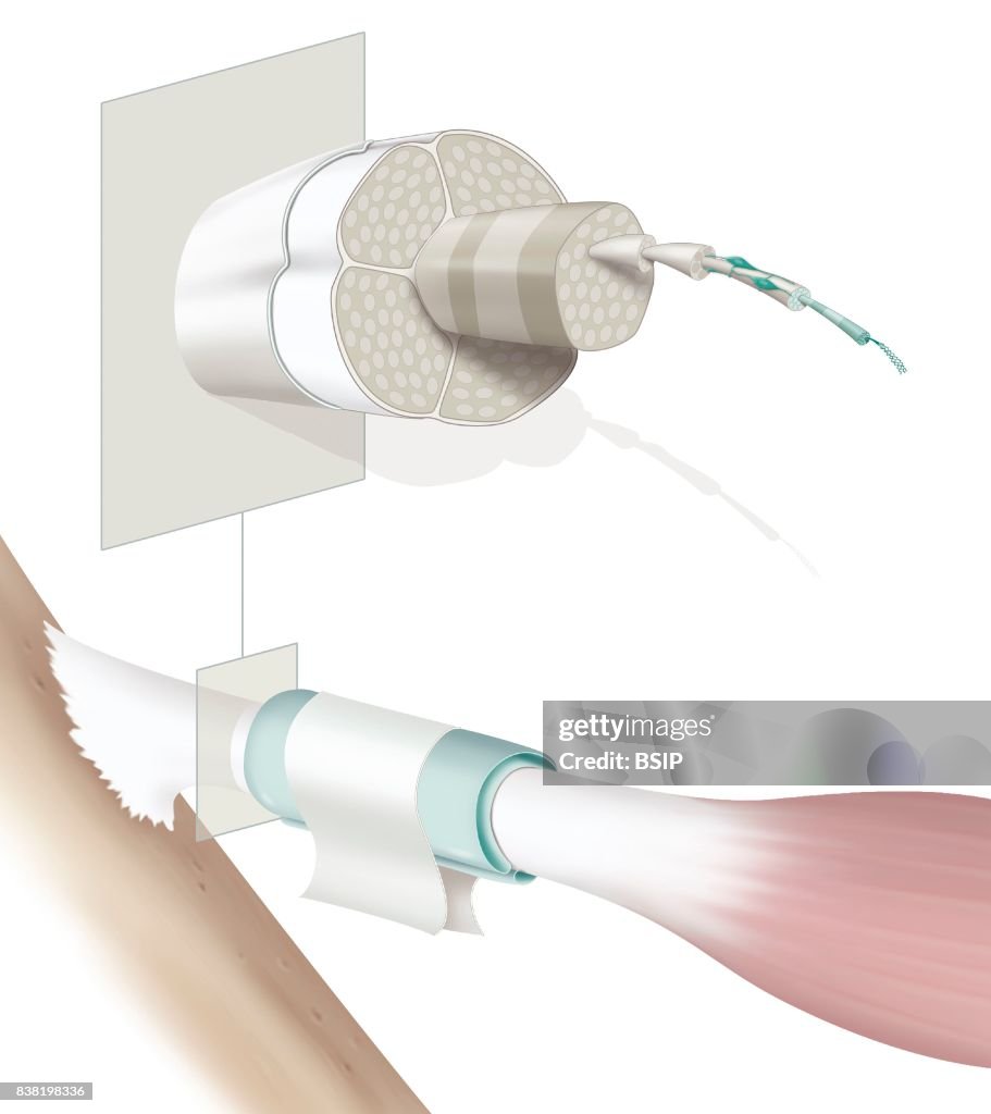 Tendon Without Label Illustration of the anatomy of a tendon and its structure. At the ...