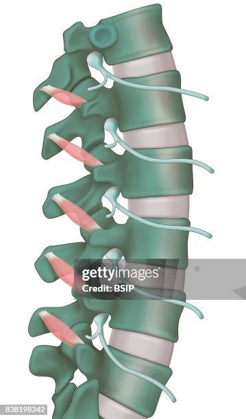 Illustration of a lengthened spinal column under the effects of microgravity, observed during an experiment to show the principle of dry immersion,...