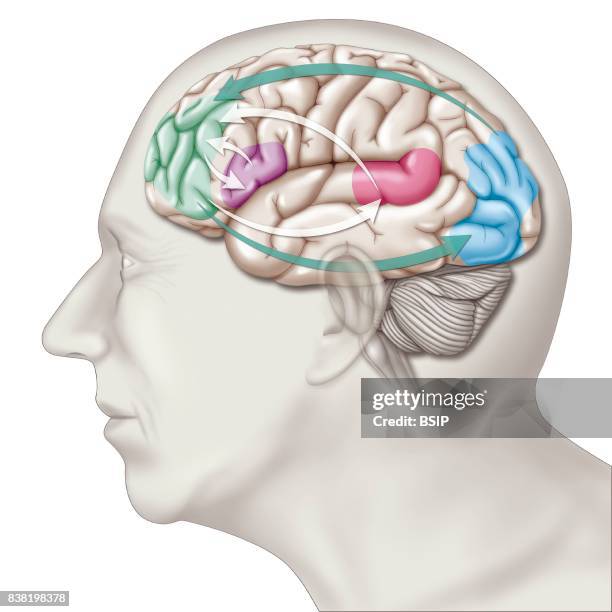 Illustration of the areas of the brain affected in the case of transient global amnesia, TGA), a pathology affecting short-term memory. Two types of...