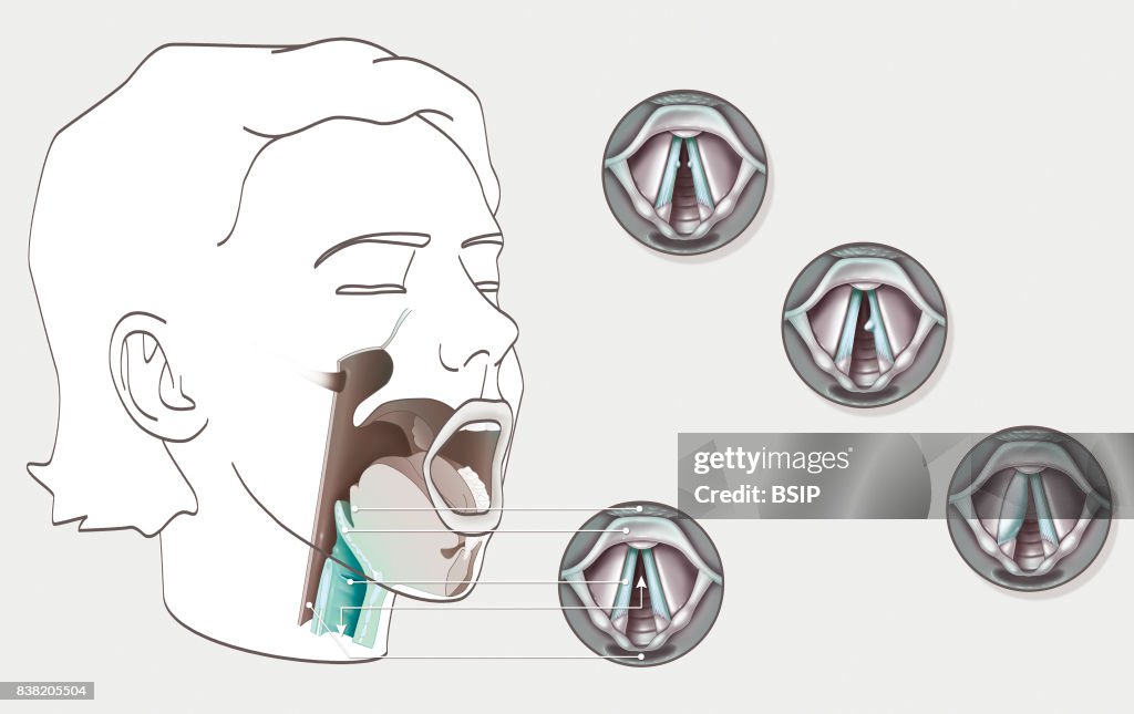 Vocal cord, illustration
