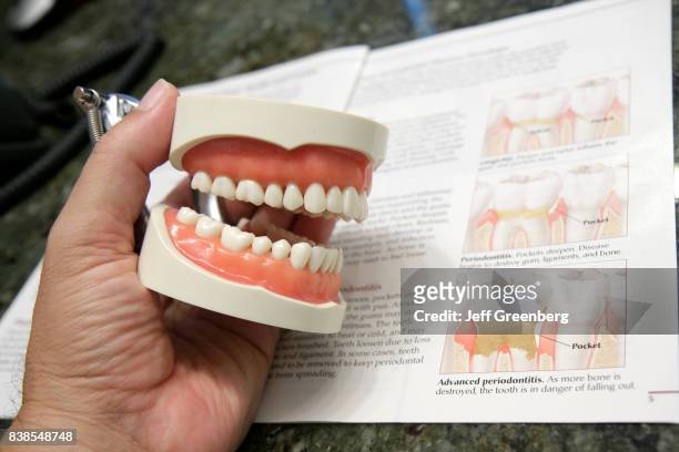 Teeth model in a periodontitis office in Miami.